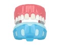 3d render of upper jaw with dental impression tray