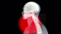 3d rendered animation of a painful neck. Man with severe pain in the neck clutching his neck. Medical concept 3d