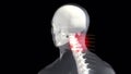 3d rendered animation of a painful neck. Man with severe pain in the neck clutching his neck. Medical concept 3d Royalty Free Stock Photo