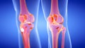 Skeletal knee joints