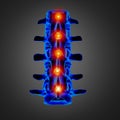 3D rendering illustration of lumbar