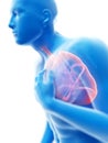 An inflamed lung Royalty Free Stock Photo