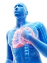 An inflamed lung Royalty Free Stock Photo