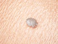 a scabies mite Royalty Free Stock Photo