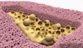 3D Rendered Image of a Pink and Yellow Foam-like Structure