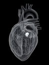 The aortic valve