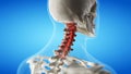 An arthritic cervical spine