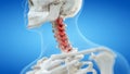 An arthritic cervical spine