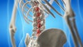 An arthritic lumbar spine Royalty Free Stock Photo