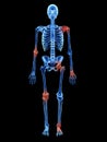 Arthrosis in the joints