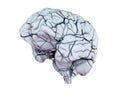 A broken human brain