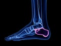 The calcaneus bone Royalty Free Stock Photo
