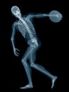 A discus thrower x-ray