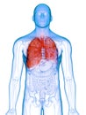 A diseased lung Royalty Free Stock Photo