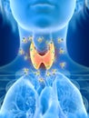 A females thyroid gland being attacked by antibodies