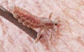 A head louse Royalty Free Stock Photo