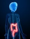 An inflamed colon Royalty Free Stock Photo