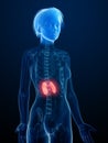 an inflamed kidneys Royalty Free Stock Photo