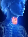 An inflamed thyroid