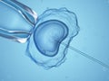 An invitro fertilization Royalty Free Stock Photo