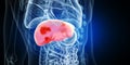 Liver tumors Royalty Free Stock Photo