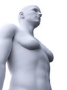 A male with gynecomastia