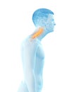 A forward head posture