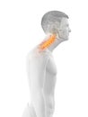 A forward head posture Royalty Free Stock Photo