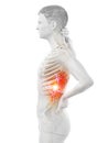 A man having acute back pain