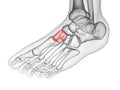 The medial cuneiform bone