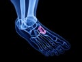 the medial cuneiform bone Royalty Free Stock Photo