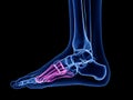 The metatarsal bone Royalty Free Stock Photo