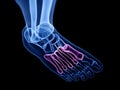 the metatarsal bones Royalty Free Stock Photo