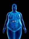 An obese mans adrenal glands