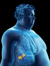 An obese mans adrenal glands Royalty Free Stock Photo