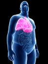 An obese mans lung Royalty Free Stock Photo
