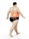 an obese runners painful back Royalty Free Stock Photo
