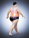 An obese runners painful back Royalty Free Stock Photo