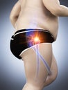 An obese runners painful hip Royalty Free Stock Photo