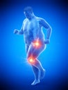 An obese runners painful joints Royalty Free Stock Photo