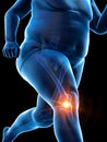 An obese runners painful knee Royalty Free Stock Photo