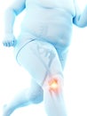 An obese runners painful knee Royalty Free Stock Photo