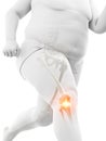 An obese runners painful knee Royalty Free Stock Photo