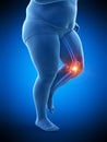 An obese runners painful knee Royalty Free Stock Photo