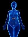 An obese womans adrenal glands