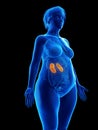 An obese womans kidneys Royalty Free Stock Photo
