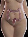 An obese womens colon Royalty Free Stock Photo