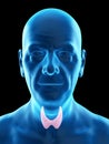 an old mans thyroid gland Royalty Free Stock Photo