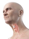 An old mans thyroid