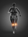 An overweight womans painful joints